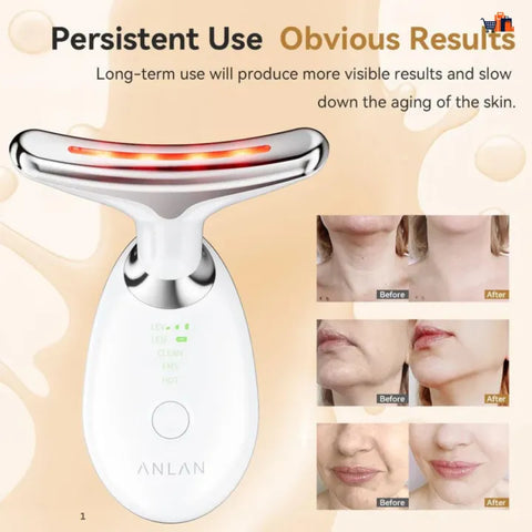 Neck Lifting & Tightening Massager – EMS Microcurrent LED Face & Neck Beauty Device